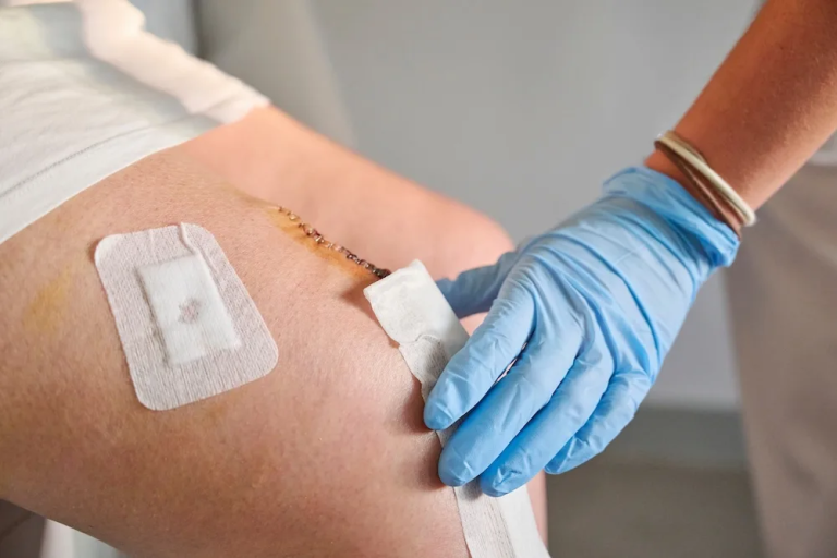 Mobile Wound Care