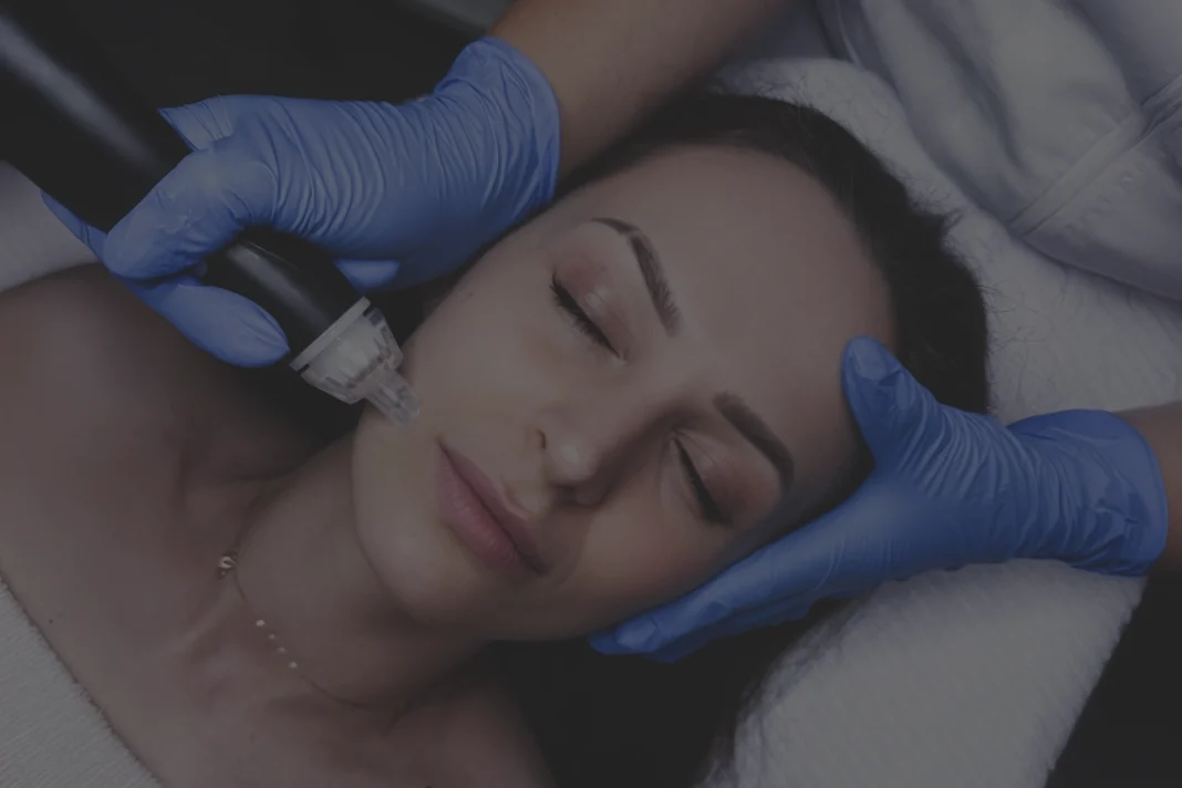 Facial Treatments Calgary