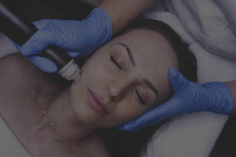 Facial Treatments Calgary