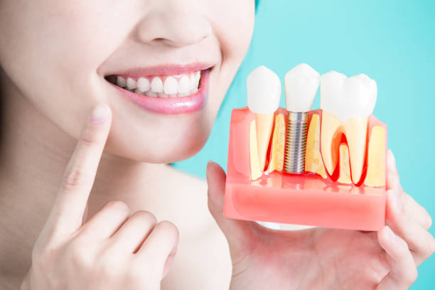dental implants in Chelsea NYC