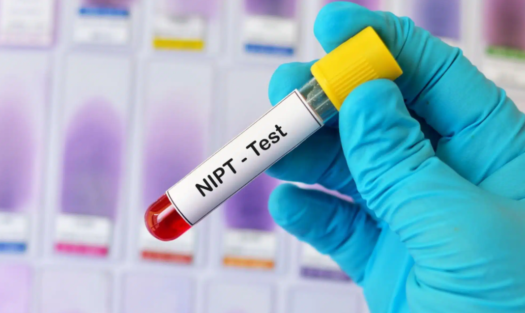 nipt เบิกได้