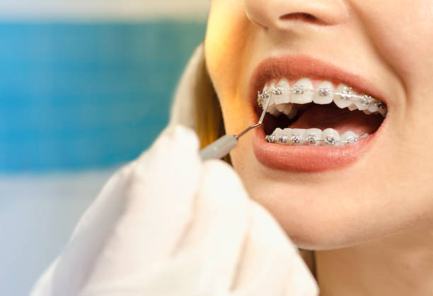 orthodontist in South Torrance
