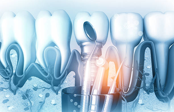 Embarcadero dentistry SF